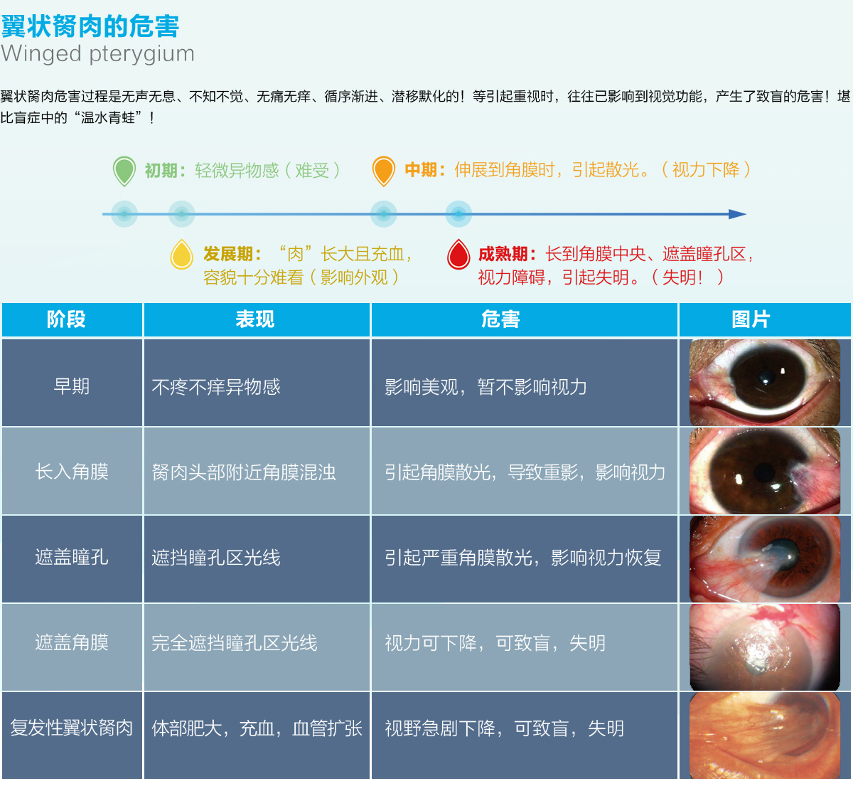 电焊闪眼睛的最快治疗 电光性眼炎的治疗_华夏智能网
