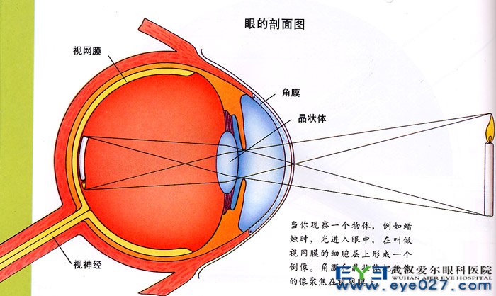 视网膜色素变性