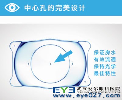武汉大学附属爱尔眼科V4c晶体手术