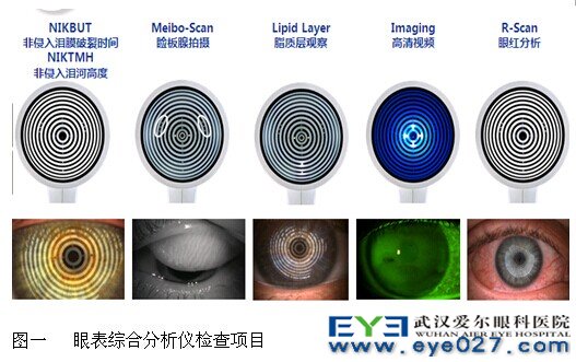 眼表综合分析仪